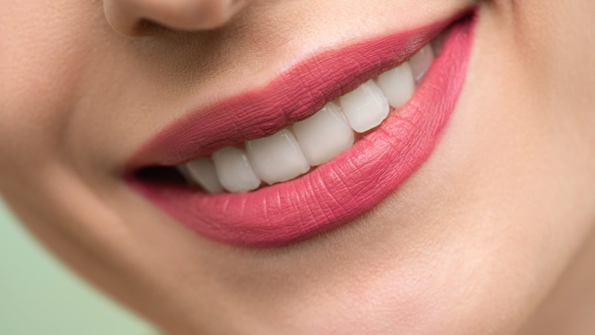 Sorriso smagliante: consigli per denti bianchi e sani. Igiene orale per un sorriso perfetto.