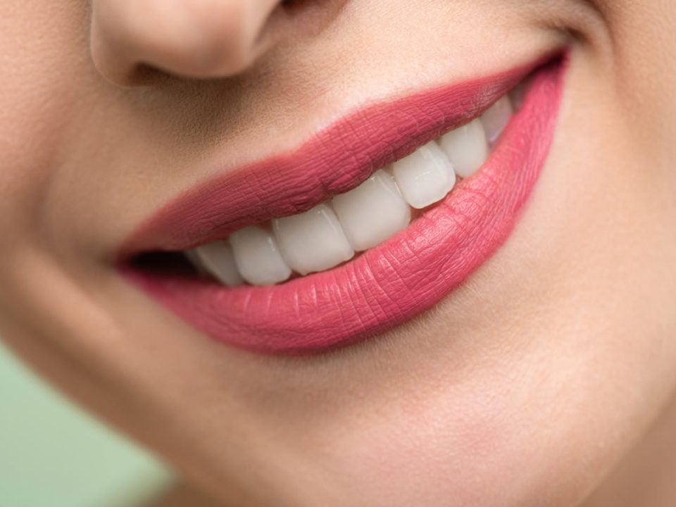 Sorriso smagliante: consigli per denti bianchi e sani. Igiene orale per un sorriso perfetto.