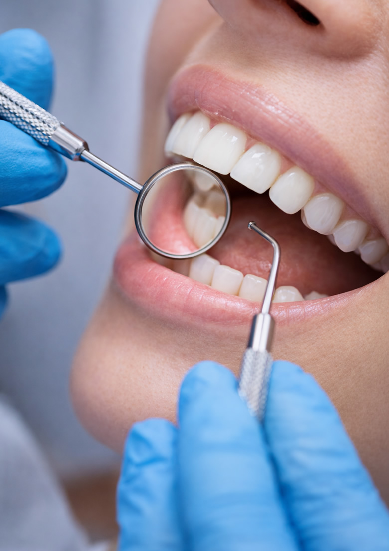 Odontoiatria conservativa a Piacenza e Lodi: controllo dentale con specchietto per una bocca sana e curata.